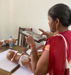 A community health worker using a tablet to diagnose jaundice